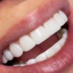 Oral Hygiene Care In Dumfries